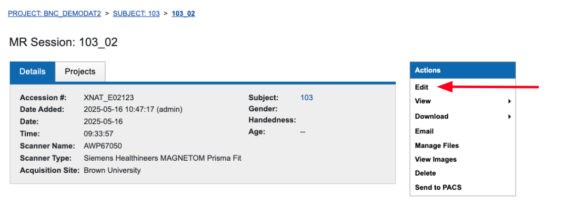 A view of the Edit button, underneath "Actions" on the right hand side of a session on XNAT. 